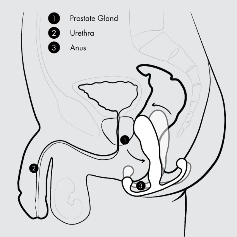 Diagram of the movement of the Aneros MGX Trident once the anal sphincter muscles are contracted